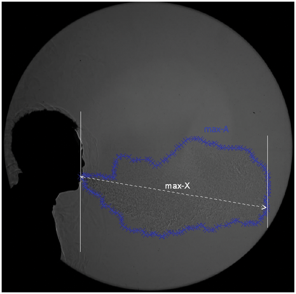 Figure 2. Illustration of the parameters digitised frame-by-frame from the high-speed airflow images captured from each volunteer: the maximum visible propagation distance (max-X) and the maximum visible 2-dimensional (2-D) area (max-A).